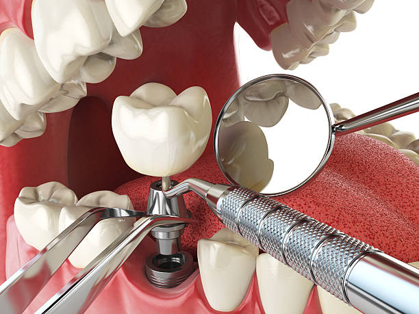 Professional Emergency Dental Service in MN